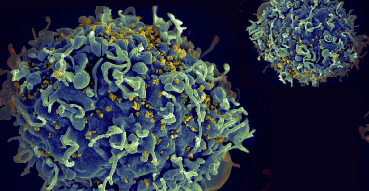 How to cure HIV permanently